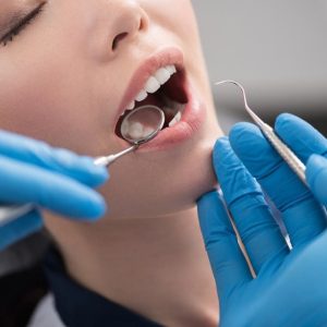 پرکردن دندان