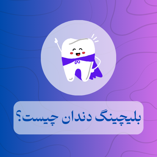 بلیچینگ دندان چیست؟