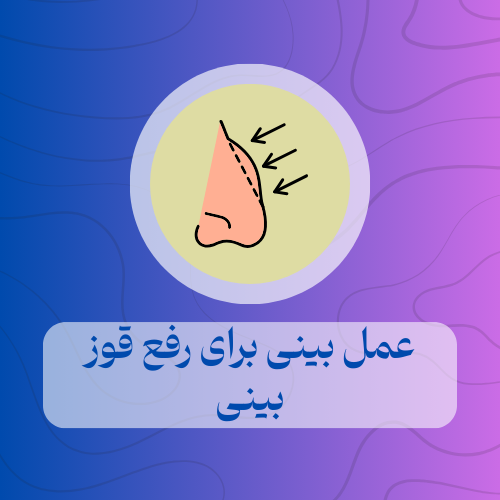 عمل بینی برای رفع قوز بینی