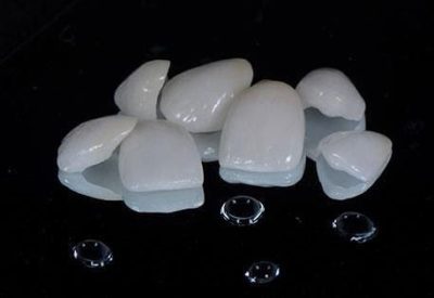 لمینت دندان