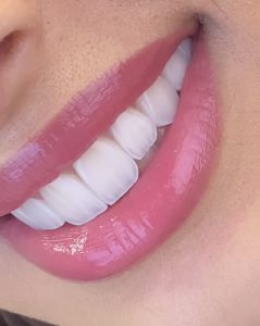 معرفی برندهای کامپوزیت