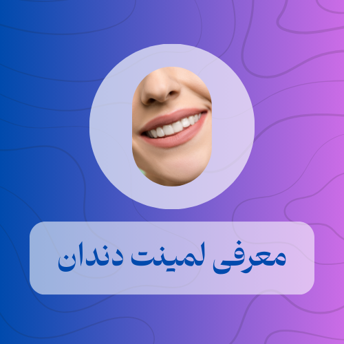 معرفی لمینت دندان