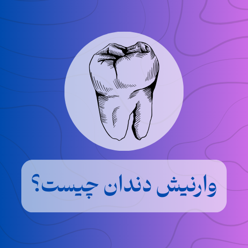 وارنیش دندان چیست؟