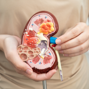 پیوند کلیه حیوان به انسان