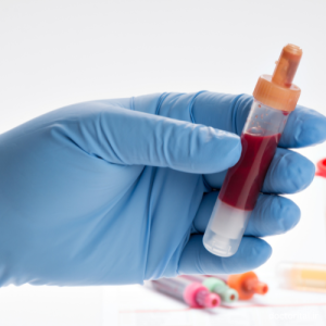 خون در ادرار سنگ کلیه