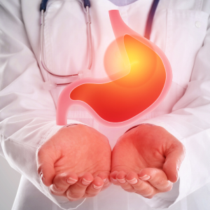 رفلاکس معده (GERD)