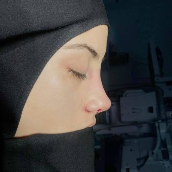 بهترین دکتر عمل بینی فانتزی