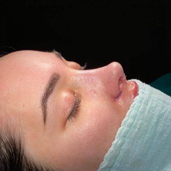 قوس بینی نیمه فانتزی