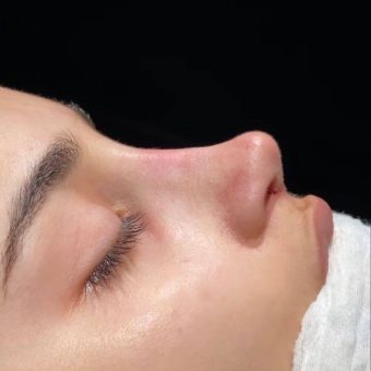 مدل بینی پرنسسی دخترانه